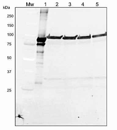western blot using anti-LOX antibodies
